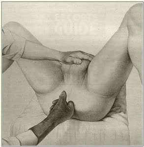 PROSTATE MASSAGE. 